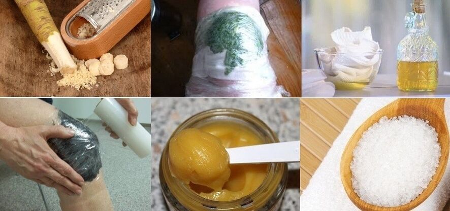 Ang mga katutubong remedyo para sa arthrosis ng kasukasuan ng tuhod