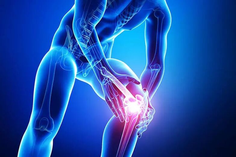 sintomas ng arthrosis