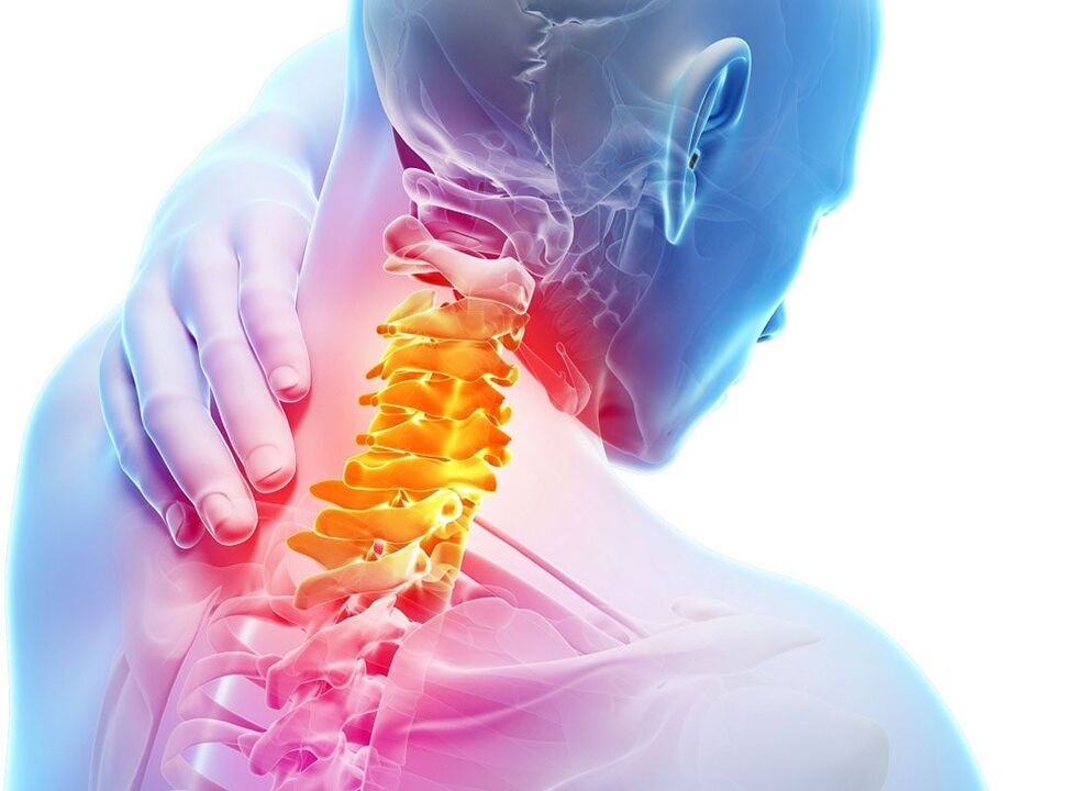 osteochondrosis ng cervical spine